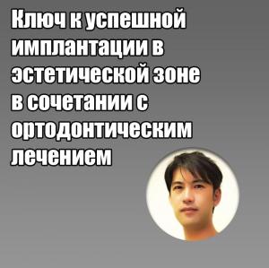 Видеозапись. Цутому Танно - Ключ к успешной имплантации в эстетической зоне в сочетании с ортодонтическим лечением - Книги по имплантологии (фото 1)