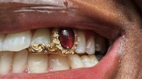 Грилзы на зубы 8