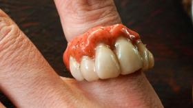 Кольцо для стоматолога 32