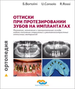 С. Бoртолини - Оттиски при протезировании зубов на имплантатах - Книги по ортопедической стоматологии (фото 1)