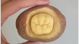 Картофельный зуб 2