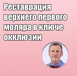 Видеозапись. Сергей Радлинский - Реставрация верхнего первого моляра в ключе окклюзии - Книги по реставрационной стоматологии (фото 1)