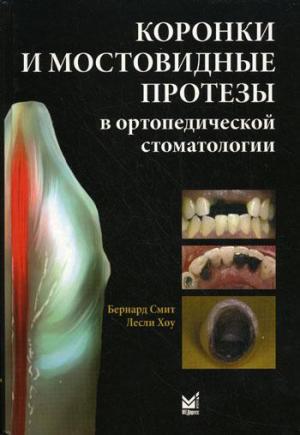 Бернард Смит, Лесли Хоу - Коронки и мостовидные протезы в ортопедической стоматологии - Книги по ортопедической стоматологии (фото 1)