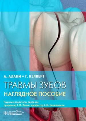 Алани А., Кэлверт Г. - Травмы зубов. Наглядное пособие - Книги по терапевтической стоматологии (фото 1)