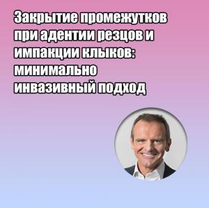 Видеозапись. Марко Роза - Закрытие промежутков при адентии резцов и импакции клыков: минимально инвазивный подход - Книги по ортодонтии (фото 1)