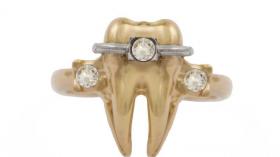 Кольцо для стоматолога 17