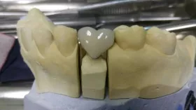 Зубная любовь 12