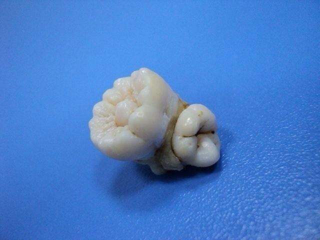 Зуб на зубе