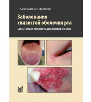 Цветкова А.А. - Заболевания слизистой оболочки рта. Связь с общей патологией. Диагностика. Лечение. - Книги по общей стоматологии (фото 1)