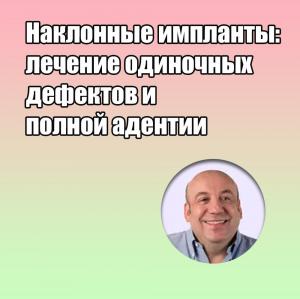 Видеозапись. Энрико Альярди - Наклонные импланты: лечение одиночных дефектов и полной адентии - Книги по имплантологии (фото 1)