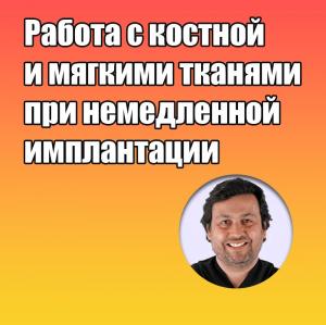 Видеозапись. Дарсио Луис Фонсека - Работа с костной и мягкими тканями при немедленной имплантации - Книги по имплантологии (фото 1)