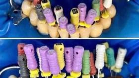 Когда хобби стоматолога - иглоукалывание