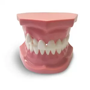GF Dental ORB05 Ортодонтическая модель с брекетами и твердой десной, 3 класс - Модели для практики (муляжи, тренажеры) (фото 1)