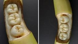 Банановые зубы 3
