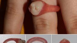 Кольцо для стоматолога 14