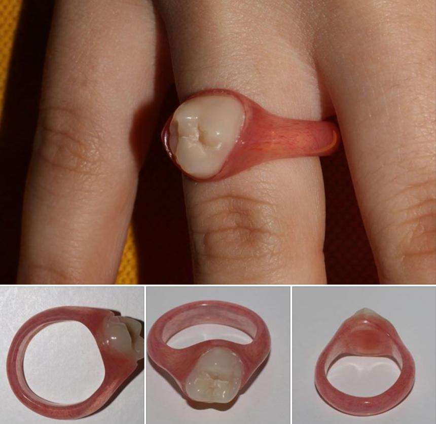 Кольцо для стоматолога 14