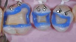 Вот такие мы разные зубы