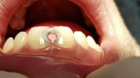 Зубная любовь 13