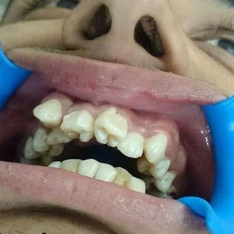 Photoshop или аномалия зубов?