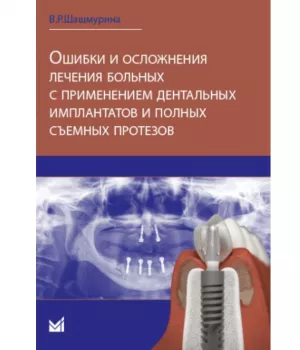 В. Р. Шашмурина - Ошибки и осложнения лечения больных с применением дентальных имплантов и полных съемных протезов - Книги по имплантологии (фото 1)