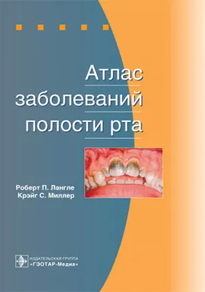 Лангле Р.П., Миллер К.С. - Атлас заболеваний полости рта - Книги по общей стоматологии (фото 1)
