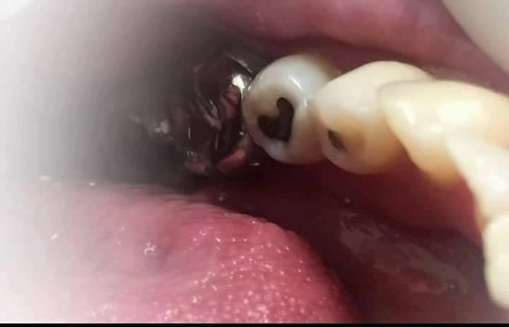 Зубная любовь 15