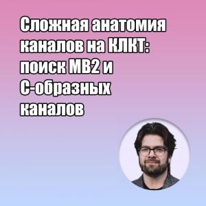 Видеозапись. Михаил Соломонов - Сложная анатомия каналов на КЛКТ: поиск MB2 и С-образных каналов - Книги по эндодонтии (фото 1)