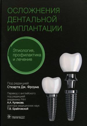 Стюарт Дж. Фроум - Осложнения дентальной имплантации. Этиология, профилактика и лечение - Книги по имплантологии (фото 1)