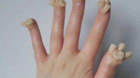 Зубные пальцы