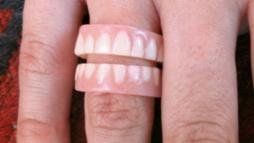 Кольцо для стоматолога 16