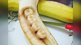Банановые зубы 2