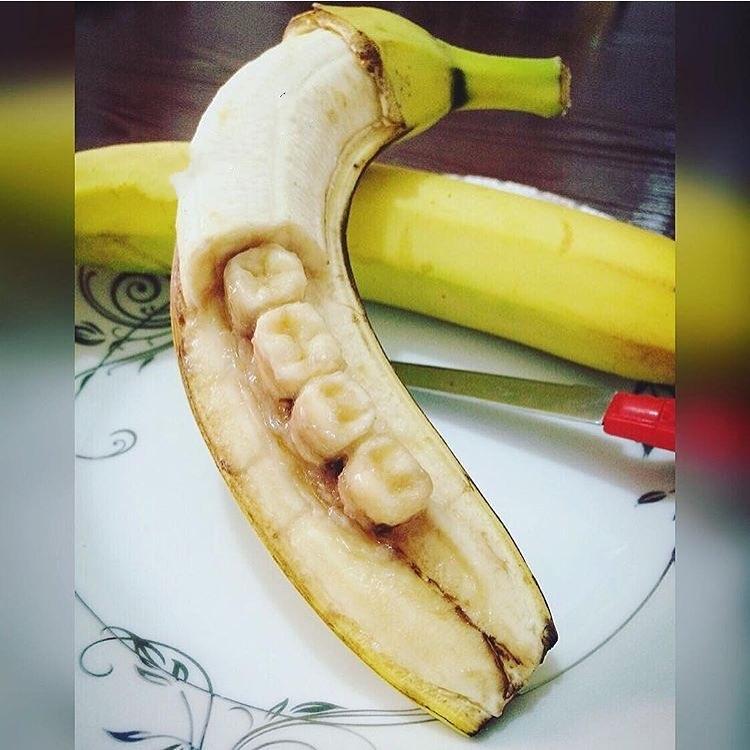 Банановые зубы 2