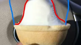 Зуб из мороженого 3
