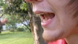 Слюнные железы в действии