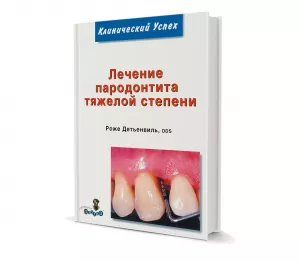 Роже Детьевниль - Лечение пародонтита тяжелой степени - Книги по пародонтологии (фото 1)