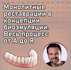 Видеозапись. Рикардо Шефер - Монолитные реставрации в концепции биоэмуляции. Весь процесс от А до Я. - Книги по ортопедической стоматологии (фото 1)
