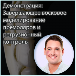 Видеозапись. Инго Рётеле - Демонстрация: Завершающее восковое моделирование премоляров и ретрузионный контроль️ - Книги для зубных техников (фото 1)