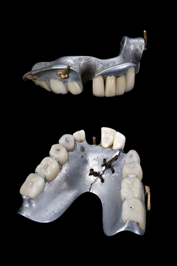 Частично съемный зубной протез на верхнюю и нижнюю челюсть (1858-1880гг.)