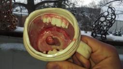 Чашка стоматолога 5