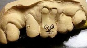 Пасхальный зуб