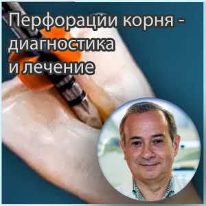 Видеозапись. Антонио Гинджейра - Перфорации корня - диагностика и лечение - Книги по эндодонтии (фото 1)