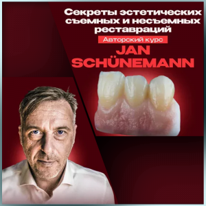 Видеозапись. Ян Шюнеманн - Секреты эстетических съемных и несъемных реставраций - Книги для зубных техников (фото 1)