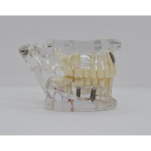 Типодонт Модель челюсти прозрачная - Демонстрационные модели (фото 1)