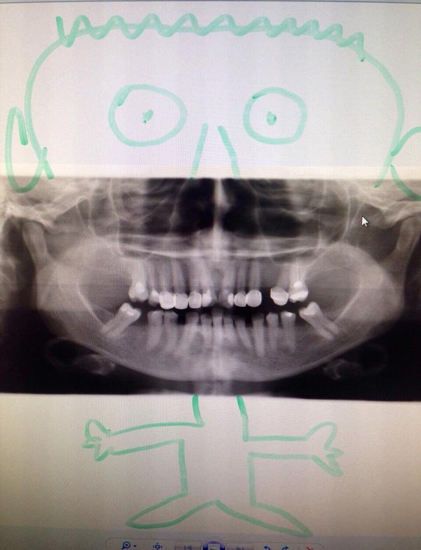 Пациент не мог понять где какой зуб