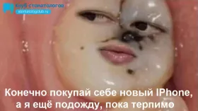 Новый iPhone или вылечить зуб?