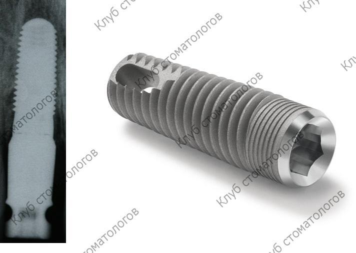 Zimmer Tapered Screw-Vent
