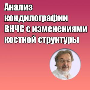 Видеозапись. Грегор Славичек - Анализ кондилографии ВНЧС с изменениями костной структуры - Книги по хирургической стоматологии (фото 1)