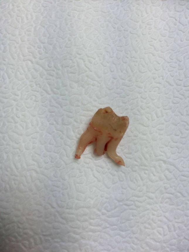 Зуб - мальчик 2