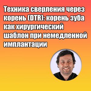 Видеозапись. Дарсио Луис Фонсека - Техника сверления через корень (DTR): корень зуба как хирургический шаблон при немедленной имплантации - Книги по имплантологии (фото 1)