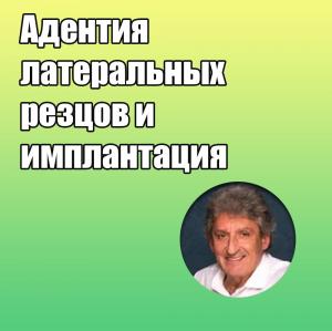 Видеозапись. Жан-Марк Дерсо - Адентия латеральных резцов и имплантация - Книги по имплантологии (фото 1)